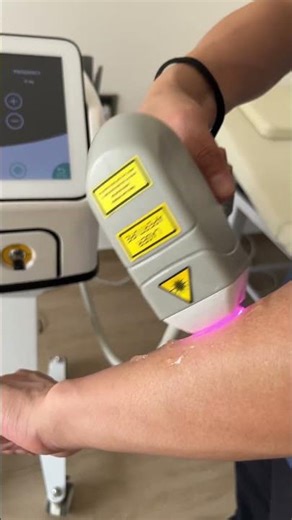 808nm Diode Laser Hair Removal Machine