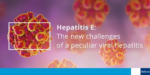 Hepatitis E: The new challenges of a peculiar viral hepatitis