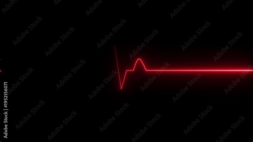 Red EKG flat line. Cardiogram pulse monitor showing heart attack emergency or cardiac arrest. Medical device animation.