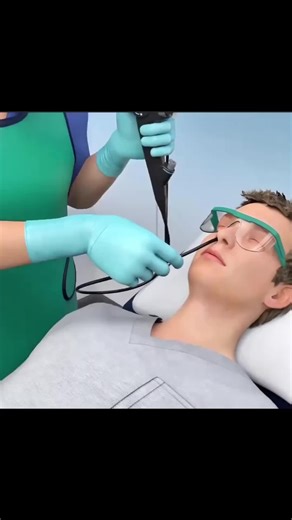Bronchoscopy Procedure (3D Animation) #bronchoscopy #lungs #doctor #medicine #3danimation