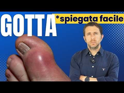 Gout: Causes, Symptoms, Diet and Treatment (What Foods to Avoid?)