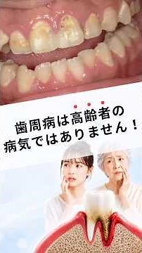 Gum disease is not just for the elderly! #NakanoDentalClinic #OkayamaDentist #GumDisease #GumDise...