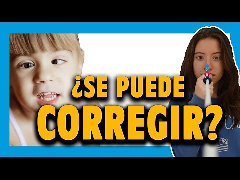 🔵 VISION THERAPY for STRABISMUS: Exercises to correct it? [Chapter #4]