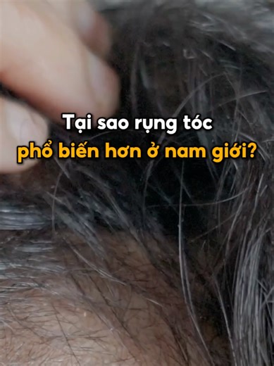 Tại sao đàn ông lại rụng nhiều tóc hơn phụ nữ? #Codeage #CodeageVietnam