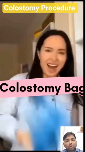 Colostomy Procedure use in international obstruction #nursing #medicare #doctor #hospital #surgical