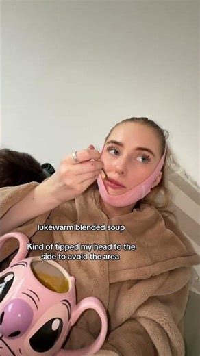 Everything I ate after getting my wisdom tooth out on day one