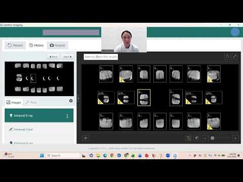 Dentrix Imaging Software Viewing Rads Tutorial