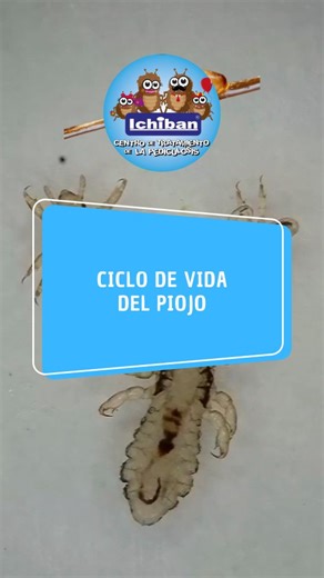 Ichiban - Eliminación de Piojos y Liendres (Pediculosis) on Instagram: "📌Conocer el ciclo de vida del Piojo es super importante ya que de esta manera entenderás como abordar y tratar la Pediculosis. #somosichiban #ciclodevida #piojos #lice #headlice #piolho #poux#piolho"
