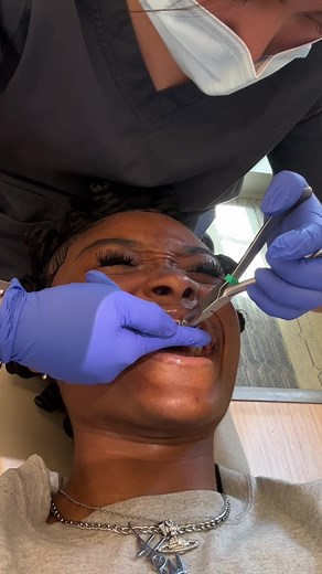 Braces Off Vlog: What to Expect and Before & After