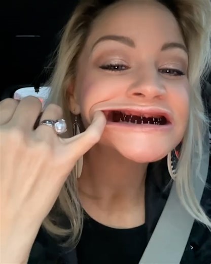 3.9M views · 15K reactions | This is how I eat with dentures 醴 | FOODbible | Facebook