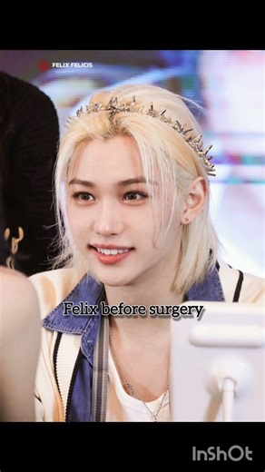 felix before and after surgery #felix #straykids #100kview #10subscriber