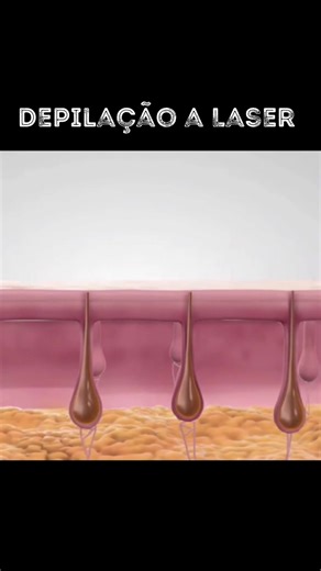 Como Funciona a Depilação a Laser: Guia Completo