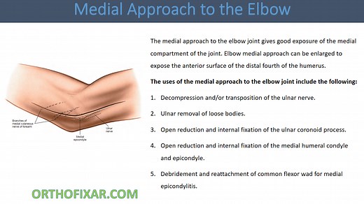 Medial Approach To The Elbow • Easy Tutorial