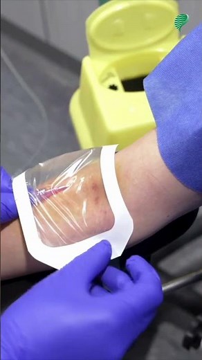 Scanner Thoracique : Tout ce qu'il Faut Savoir ! 🩻✨ #Radiologie #Diagnostic