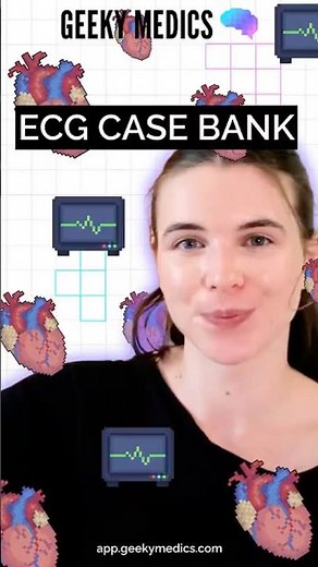 ECG Case Collection
