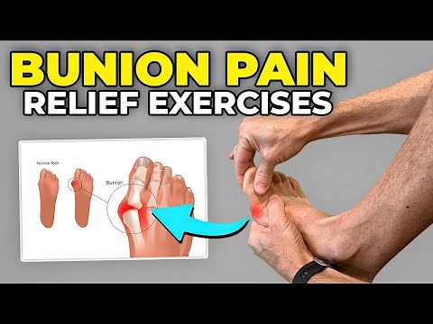 3 Bunion Pain Exercises