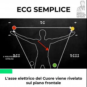 134K views · 643 reactions | IMPARARE A LEGGERE UN...