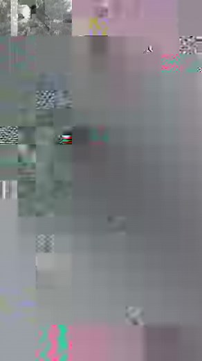 35K views · 325 reactions | The profession of radiographers...