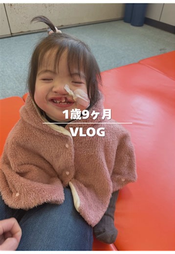 口唇口蓋裂と気管狭窄の現実
