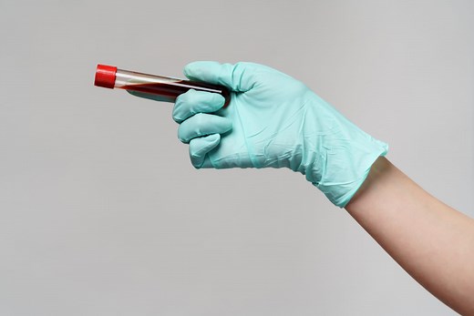 Anticorps anti-TP0 : comment interpréter ses résultats ?