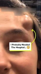 77K views · 35 reactions | Huge bump swelled up on my head all of a sudden  | Four Nine Looks | Facebook