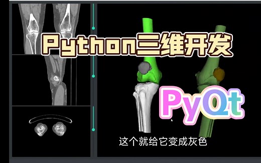 Python PyQt 三维建模 三维重建 骨骼三维重建 医疗软件开发 三维可视化系统