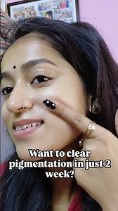 How to Remove Pigmentation with Just 1 Cream #skincare #glassskin #youtube #viral #shorts #ytshorts