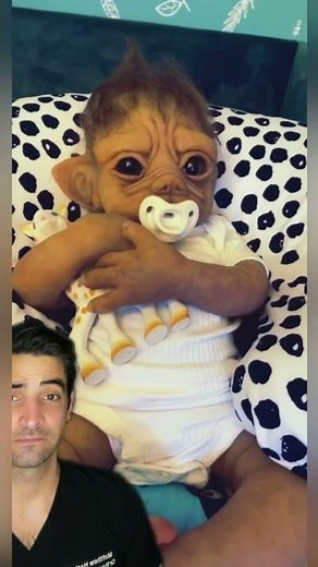 Progeria leads to Rapid Aging of Children