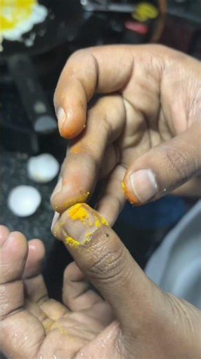 One Half Boiled Egg Story 🥲