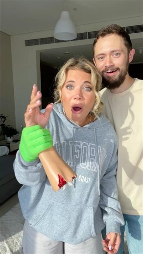 The FAKE Arm! 😱 (UNREAL)