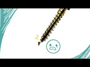 How to prevent screw fracture｜【Chris Chang Ortho】CC657