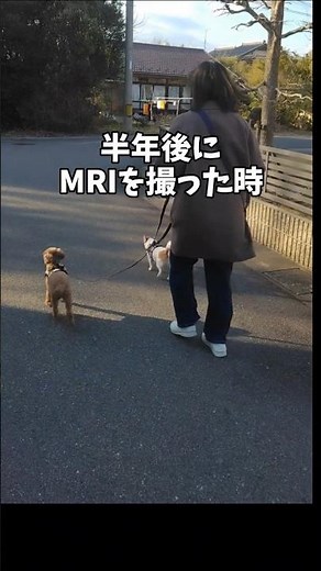 脳梗塞のあと血管復活した話