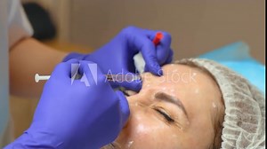 Close up botulotoxin injection procedure in modern cosmetology clinic. Botulinum therapy. Beautician makes anti aging injections for female face skin using syringe in cosmetology. Cosmetic