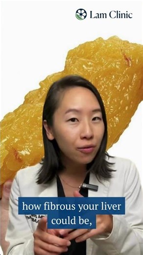 Is Your Liver Healthy? This Quick FibroScan Test Can Tell You