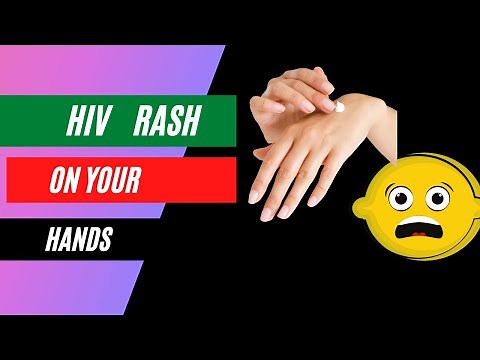 Is a rash on hands a sign and symptoms of HIV or AIDs