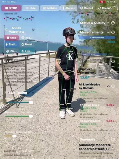 OrthoGait App | Real-Time Gait & Posture Review on iPhone, iPad and Apple Vision Pro