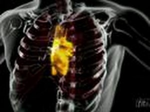 Death By French Fry | I Was Impaled