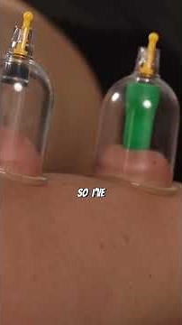 Massage + Cupping for Biceps Pain Relief