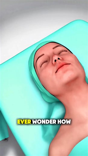 60K views · 395 reactions | “How Thyroid Removal Surgery Is Done!...