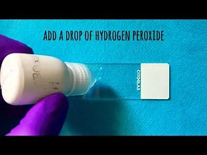 Catalase and Oxidase Test | clinical microbiology essentials