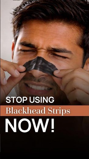 How to Remove Sebaceous Filaments | Blackheads vs Sebaceous Filaments | Dr Ruchi | Satya Clinic