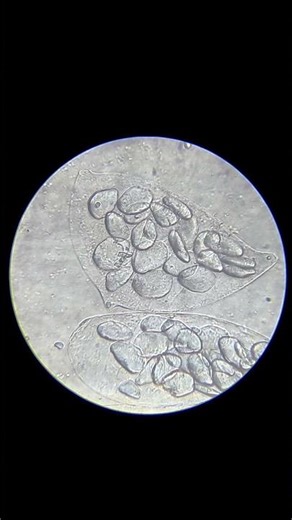 What Does a Banana Look Like Under a Microscope? #banana #biologyexperiment #science