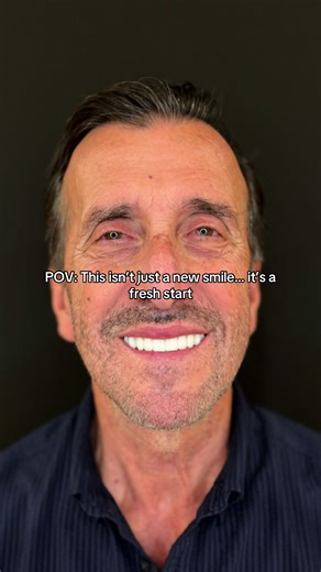 He came in self-conscious, discouraged by past dental work, and unsure if he’d ever feel confident again. Today, after his full smile makeover, he’s not just smiling — he’s living fully and proudly. 💛 Ready for your transformation? Free All-on-4® consults financing available. 📲 Call/text (951) 297-7959 #dentalimplants #allonfour #toothless #smilemakeover #allon4implants