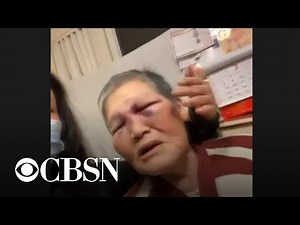 Elderly Asian woman attacked in San Francisco fights back