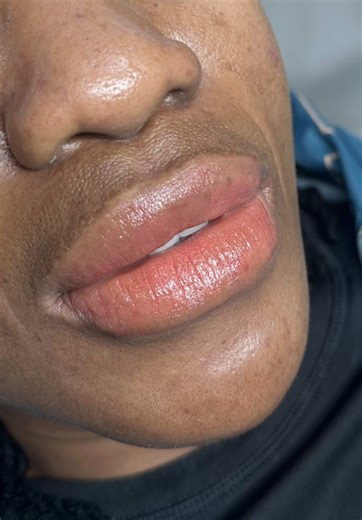 Lip Correction Techniques for a Flawless Finish