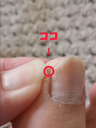 陥入爪のセルフケア方法とネイルケアのコツ