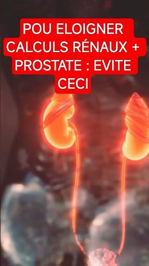 4 Foods to Avoid to Prevent Kidney and Prostate Stones