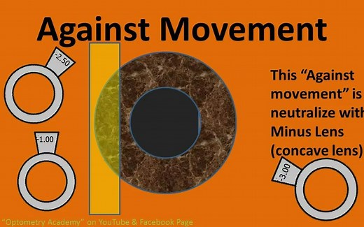 [眼视光]视网膜检影 Retinoscopy 步骤分解的很细！