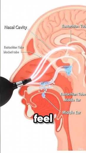 Balloon Inside the Nose?! 😳 Instant Sinus & Ear Relief Explained (Endonasal Therapy)