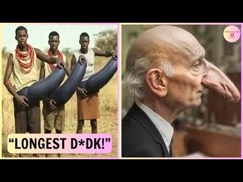 Top 25 People With Bigger Than Normal Body Parts | Then and Now 2025